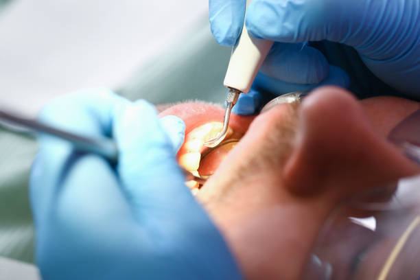 Best Urgent Dental Care in Roodhouse, IL