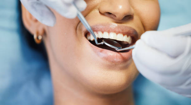 Best Emergency Dental Surgery in Roodhouse, IL